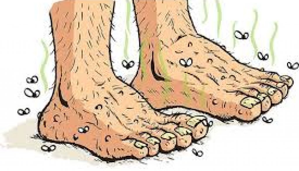 A cartoon of hairy feet and legs with flies around them